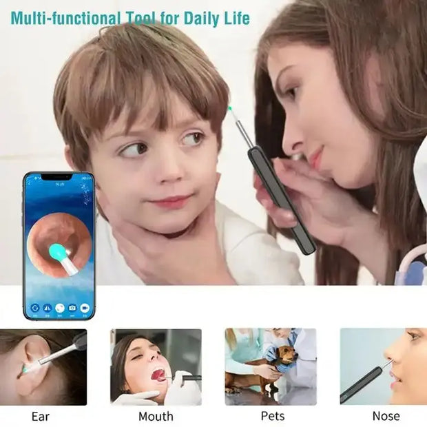 Wireless Smart Visual Ear Cleaner