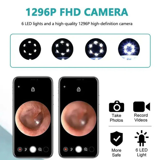 Wireless Smart Visual Ear Cleaner