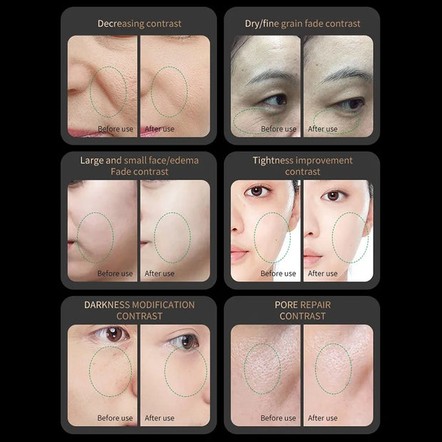 Anti-Aging Face Lifting Massager